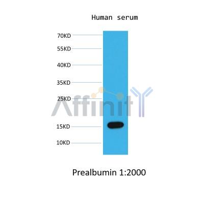 Western blot analysis of  human serum,using Prealbumin mouse monoclonal antibody.