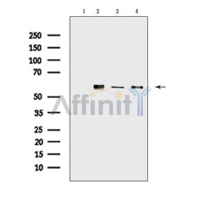 Vimentin mouse monoclonal Antibody [AFfirm079] -BF8006