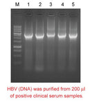 Mbead Virus Genomic Nucleic Acid Kit - 100 reactions PDM04-0100