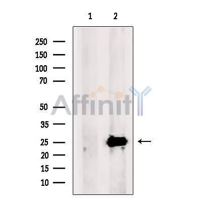 Western blot analysis SCGN using HUVEC whole cell lysates