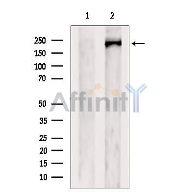 Western blot analysis of extracts from VERO, using RB1CC1 Antibody. The lane on the left was treated with blocking peptide.