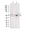 DF12072 staining Hela by IF/ICC. The samples were fixed with PFA and permeabilized in 0.1% Triton X-100,then blocked in 10% serum for 45 minutes at 25¡ãC. Samples were then incubated with primary Ab(DF12072 1:200) and mouse anti-beta tubulin Ab(T0023 1:200) for 1 hour at 37¡ãC. An  AlexaFluor594 conjugated goat anti-rabbit IgG(H+L) Ab(S0006 1:200 Red) and an AlexaFluor488 conjugated goat anti-mouse IgG(H+L) Ab(S0017 1:600 Green) were used as the secondary antibod