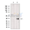 Western blot analysis of extracts from Mouse Myeloma cell, using GNMT antibody. Lane 1 was treated with the blocking peptide.