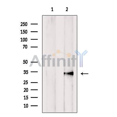 Western blot analysis of extracts from Mouse Myeloma cell, using GNMT antibody. Lane 1 was treated with the blocking peptide.