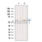 DF12130 at 1/100 staining Mouse muscle tissue by IHC-P. The sample was formaldehyde fixed and a heat mediated antigen retrieval step in citrate buffer was performed. The sample was then blocked and incubated with the antibody for 1.5 hours at 22¡ãC. An HRP conjugated goat anti-rabbit antibody was used as the secondary