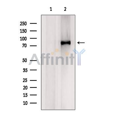 DF12149 at 1/100 staining Rat brain tissue by IHC-P. The sample was formaldehyde fixed and a heat mediated antigen retrieval step in citrate buffer was performed. The sample was then blocked and incubated with the antibody for 1.5 hours at 22¡ãC. An HRP conjugated goat anti-rabbit antibody was used as the secondary