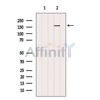 DF12171 staining HepG2 by IF/ICC. The sample were fixed with PFA and permeabilized in 0.1% Triton X-100,then blocked in 10% serum for 45 minutes at 25¡ãC. The primary antibody was diluted at 1/200 and incubated with the sample for 1 hour at 37¡ãC. An  Alexa Fluor 594 conjugated goat anti-rabbit IgG (H+L) Ab, diluted at 1/600, was used as the secondary antibod