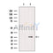 DF12217 at 1/100 staining Rat brain tissue by IHC-P. The sample was formaldehyde fixed and a heat mediated antigen retrieval step in citrate buffer was performed. The sample was then blocked and incubated with the antibody for 1.5 hours at 22¡ãC. An HRP conjugated goat anti-rabbit antibody was used as the secondary