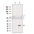 DF12252 at 1/100 staining Rat liver tissue by IHC-P. The sample was formaldehyde fixed and a heat mediated antigen retrieval step in citrate buffer was performed. The sample was then blocked and incubated with the antibody for 1.5 hours at 22¡ãC. An HRP conjugated goat anti-rabbit antibody was used as the secondary