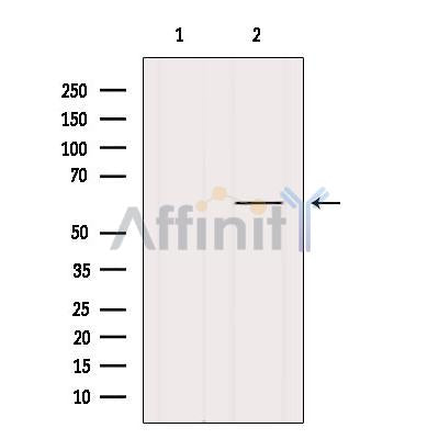 DF12264 at 1/100 staining Human kidney tissue by IHC-P. The sample was formaldehyde fixed and a heat mediated antigen retrieval step in citrate buffer was performed. The sample was then blocked and incubated with the antibody for 1.5 hours at 22¡ãC. An HRP conjugated goat anti-rabbit antibody was used as the secondary