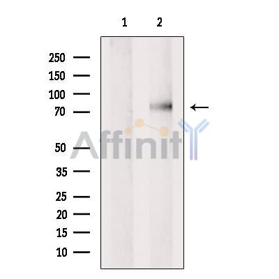 Western blot analysis of extracts from Mouse lung, using MECP2 Antibody. The lane on the left was treated with blocking peptide.