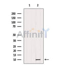 DF12335 at 1/100 staining Rat liver tissue by IHC-P. The sample was formaldehyde fixed and a heat mediated antigen retrieval step in citrate buffer was performed. The sample was then blocked and incubated with the antibody for 1.5 hours at 22¡ãC. An HRP conjugated goat anti-rabbit antibody was used as the secondary