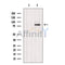 DF12418 at 1/100 staining Human pancreas cancer tissue by IHC-P. The sample was formaldehyde fixed and a heat mediated antigen retrieval step in citrate buffer was performed. The sample was then blocked and incubated with the antibody for 1.5 hours at 22¡ãC. An HRP conjugated goat anti-rabbit antibody was used as the secondary
