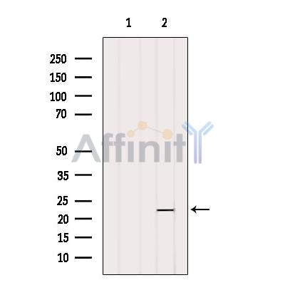 DF12433 staining Hela by IF/ICC. The sample were fixed with PFA and permeabilized in 0.1% Triton X-100,then blocked in 10% serum for 45 minutes at 25¡ãC. The primary antibody was diluted at 1/200 and incubated with the sample for 1 hour at 37¡ãC. An  Alexa Fluor 594 conjugated goat anti-rabbit IgG (H+L) Ab, diluted at 1/600, was used as the secondary antibod