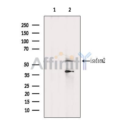 DF12454 at 1/100 staining Mouse liver tissue by IHC-P. The sample was formaldehyde fixed and a heat mediated antigen retrieval step in citrate buffer was performed. The sample was then blocked and incubated with the antibody for 1.5 hours at 22¡ãC. An HRP conjugated goat anti-rabbit antibody was used as the secondary