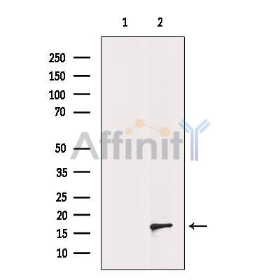 DF12468 staining Hela by IF/ICC. The sample were fixed with PFA and permeabilized in 0.1% Triton X-100,then blocked in 10% serum for 45 minutes at 25¡ãC. The primary antibody was diluted at 1/200 and incubated with the sample for 1 hour at 37¡ãC. An  Alexa Fluor 594 conjugated goat anti-rabbit IgG (H+L) Ab, diluted at 1/600, was used as the secondary antibod