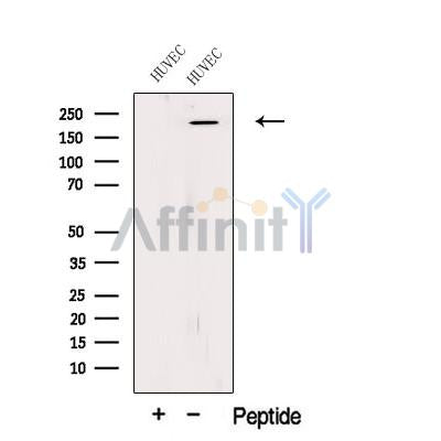 Western blot analysis of extracts from HUVEC cells, using PLXA1 Antibody. The lane on the left was treated with blocking peptide.