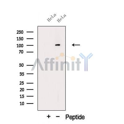 Western blot analysis of extracts from HeLa cells, using OSBL6 Antibody. The lane on the left was treated with blocking peptide.