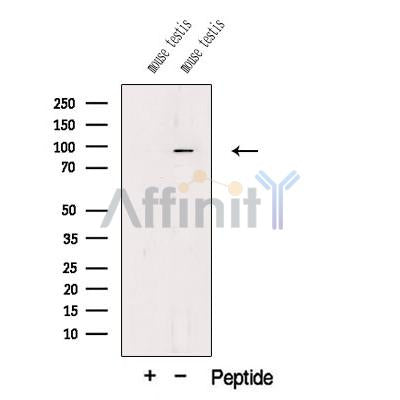 Western blot analysis of extracts from Mouse testis tissue, using PIWL1 Antibody. The lane on the left was treated with blocking peptide.