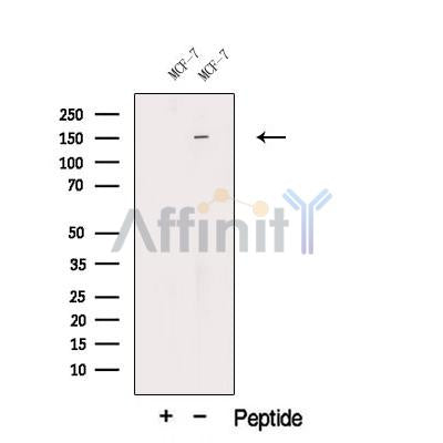Western blot analysis of extracts from Rat  brain, using SMC4 Antibody. The lane on the left was treated with blocking peptide.