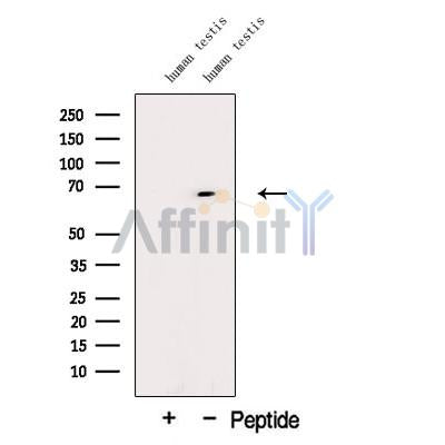 Western blot analysis of extracts from Human testis tissue, using DTX2 Antibody. The lane on the left was treated with blocking peptide.
