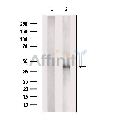 Western blot analysis of extracts from Human heart tissue, using ALP Antibody. The lane on the left was treated with blocking peptide.