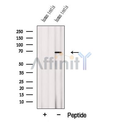 Western blot analysis of extracts from Human testis tissue, using DTX2 Antibody. The lane on the left was treated with blocking peptide.