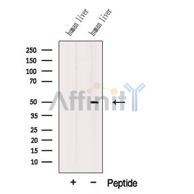 Western blot analysis of extracts from Mouse  lung, using MMP24 Antibody. The lane on the left was treated with blocking peptide.