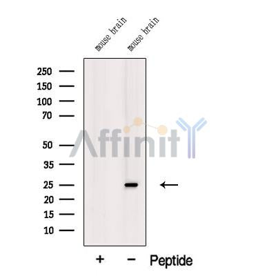 Western blot analysis of extracts from Mouse brain tissue, using TREM2 Antibody. The lane on the left was treated with blocking peptide.