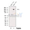 Western blot analysis of extracts from Human skin tissue, using CO5A2 Antibody. The lane on the left was treated with blocking peptide.