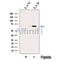 Western blot analysis of extracts from RAW cells, using TNR11 Antibody. The lane on the left was treated with blocking peptide.