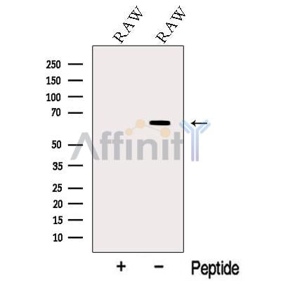Western blot analysis of extracts from RAW cells, using TNR11 Antibody. The lane on the left was treated with blocking peptide.