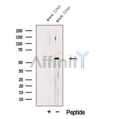 Western blot analysis of extracts from Rat  muscle, using LIPL Antibody. The lane on the left was treated with blocking peptide.
