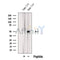 Western blot analysis of extracts from Human liver tissue, using KDM8 Antibody. The lane on the left was treated with blocking peptide.