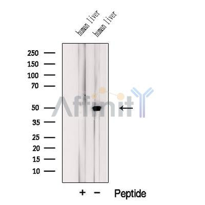 Western blot analysis of extracts from Human liver tissue, using KDM8 Antibody. The lane on the left was treated with blocking peptide.