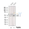 Western blot analysis of extracts from Mouse  brain, using WNT2B Antibody. The lane on the left was treated with blocking peptide.
