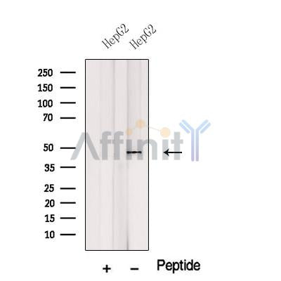 Western blot analysis of extracts from Mouse  brain, using WNT2B Antibody. The lane on the left was treated with blocking peptide.