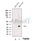 Western blot analysis of extracts from Mouse brain tissue, using TMEM9 Antibody. The lane on the left was treated with blocking peptide.