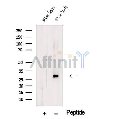 Western blot analysis of extracts from Mouse brain tissue, using TMEM9 Antibody. The lane on the left was treated with blocking peptide.