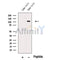 Western blot analysis of extracts from Human testis tissue, using NUTM1 Antibody. The lane on the left was treated with blocking peptide.