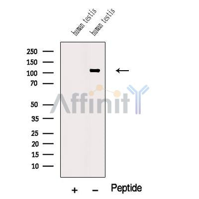 Western blot analysis of extracts from Human testis tissue, using NUTM1 Antibody. The lane on the left was treated with blocking peptide.