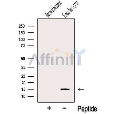 Western blot analysis of extracts from various samples, using NRN1 Antibody.
 Lane 1: HepG2 treated with blocking peptide;
 Lane 2: HepG2;
 Lane 3: Mouse  brain;
 Lane 4: Rat  brain;
 Lane 5: Rat  muscle.