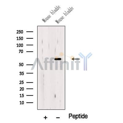 Western blot analysis of extracts from Mouse bladder tissue, using OSGI1 Antibody. The lane on the left was treated with blocking peptide.