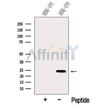 Western blot analysis of extracts from HEK-293 cells, using SIKE1 Antibody. The lane on the left was treated with blocking peptide.