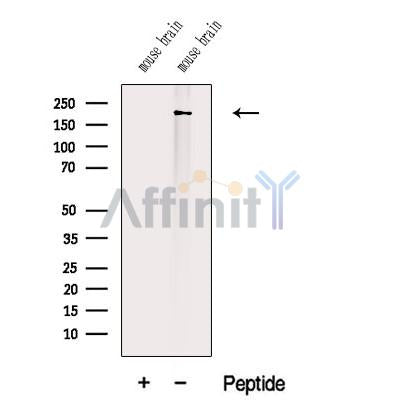 Western blot analysis of extracts from Mouse brain tissue, using TITIN Antibody. The lane on the left was treated with blocking peptide.