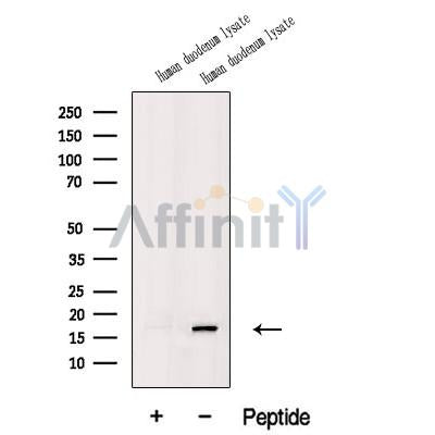 Western blot analysis of extracts from Human duodenum lysate, using CXCL2 Antibody. The lane on the left was treated with blocking peptide.