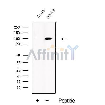 Western blot analysis of extracts from A549 cells, using UBP5 Antibody. The lane on the left was treated with blocking peptide.