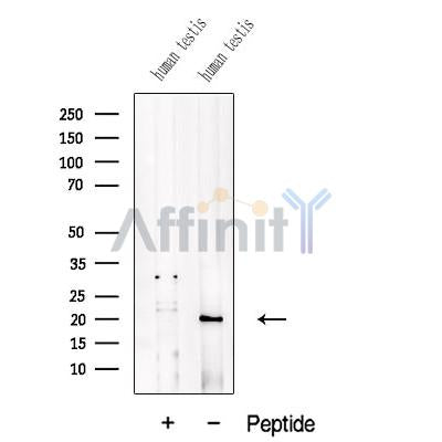 Western blot analysis of extracts from Human testis tissue, using ADI1 Antibody. The lane on the left was treated with blocking peptide.