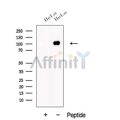 Western blot analysis of extracts from HeLa cells, using AMOTL1 Antibody. The lane on the left was treated with blocking peptide.