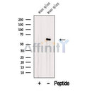 Western blot analysis of extracts from Mouse spleen  tissue, using ANGPTL2 Antibody. The lane on the left was treated with blocking peptide.